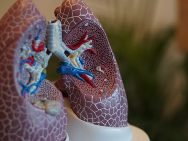 Mesothelioma Lung Cancer