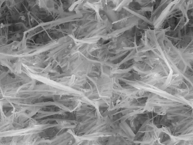Cancer Asbestos Mesothelioma