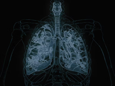 Mesothelioma Legal